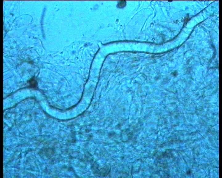 Hydropus marginellus   (Pers.:Fr.)  Singer